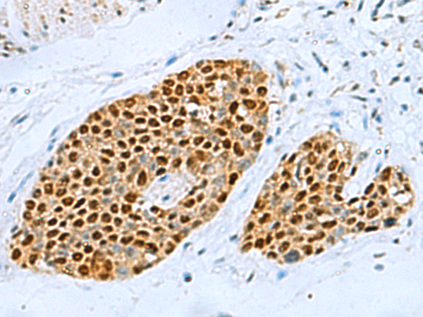 Rabbit Polyclonal Antibody to TFAP4