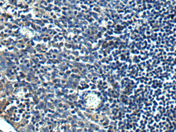 Rabbit Polyclonal Antibody to PRRT2