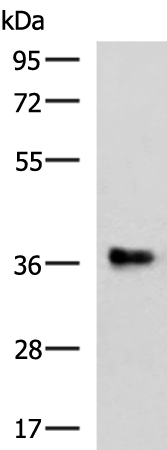 Rabbit Polyclonal Antibody to RFC5