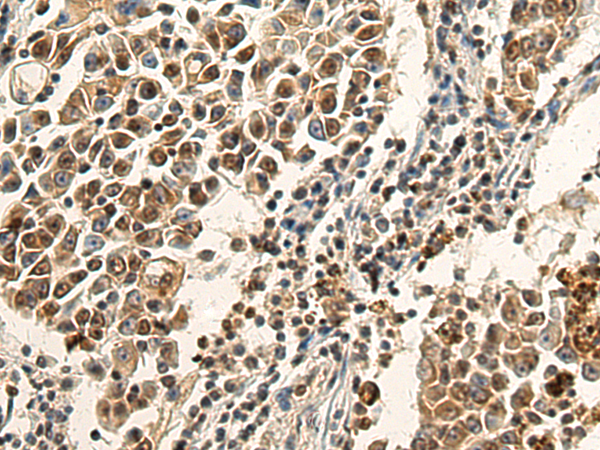 Rabbit Polyclonal Antibody to CD2BP2