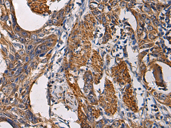 Rabbit Polyclonal Antibody to SSH3