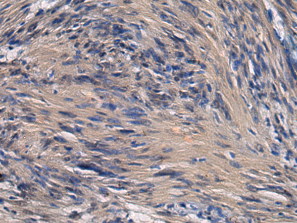 Rabbit Polyclonal Antibody to ICA1