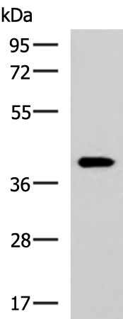 Rabbit Polyclonal Antibody to GALM