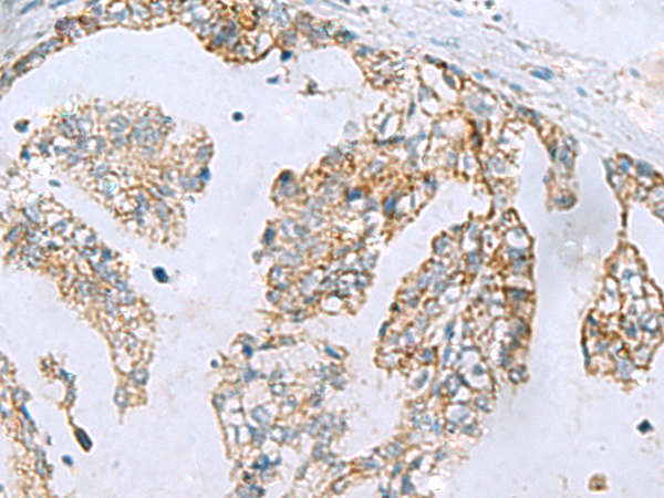 Rabbit Polyclonal Antibody to MGME1