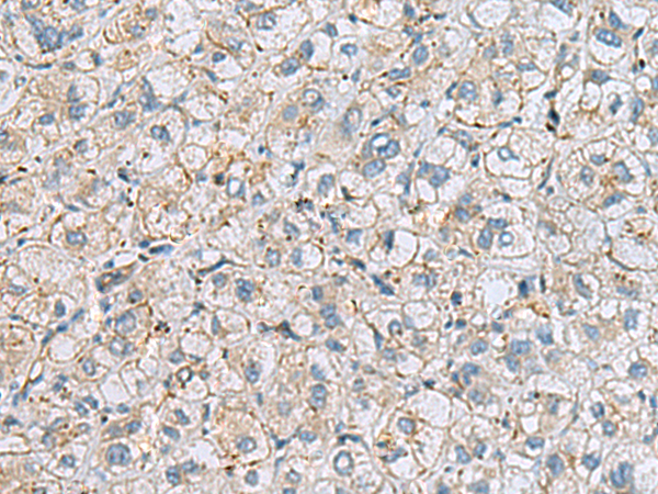 Rabbit Polyclonal Antibody to MTHFD2