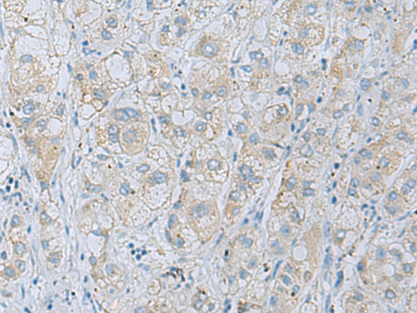 Rabbit Polyclonal Antibody to NAGK