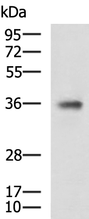 Rabbit Polyclonal Antibody to TCF19