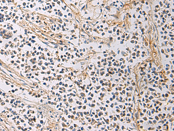 Rabbit Polyclonal Antibody to GMPR