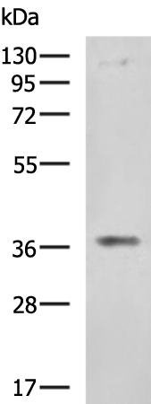 Rabbit Polyclonal Antibody to ERLIN1