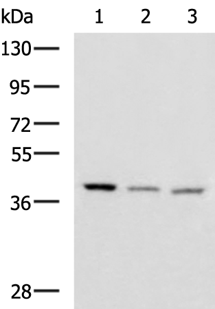 Rabbit Polyclonal Antibody to ENKD1