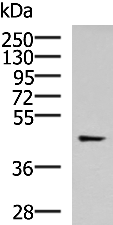 Rabbit Polyclonal Antibody to TMOD3