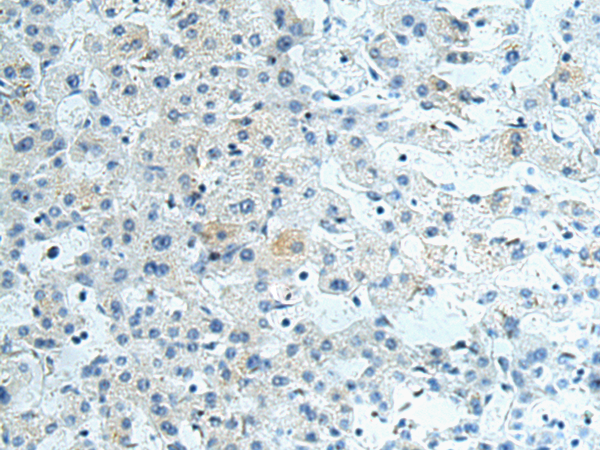 Rabbit Polyclonal Antibody to RAPSN