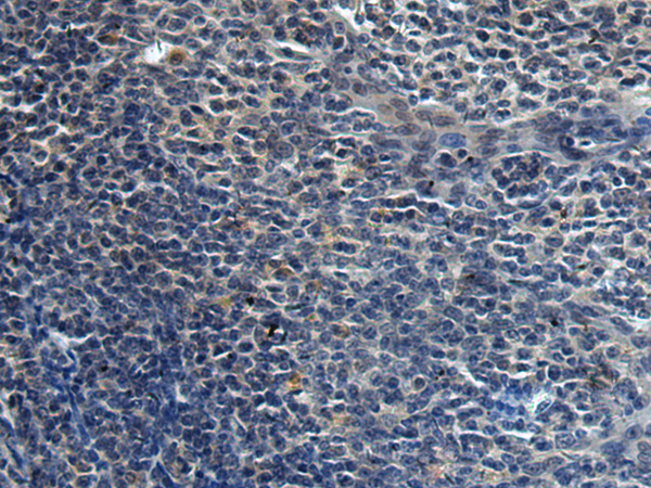 Rabbit Polyclonal Antibody to HAUS6