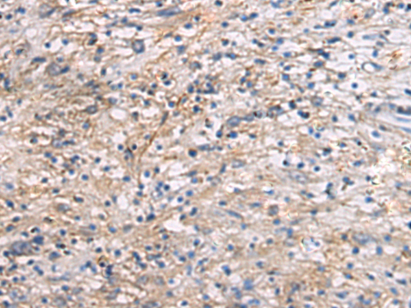 Rabbit Polyclonal Antibody to CEP89