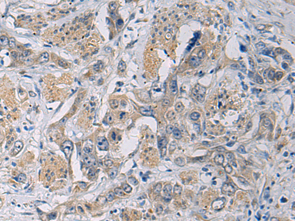 Rabbit Polyclonal Antibody to CYTIP