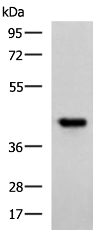 Rabbit Polyclonal Antibody to FCRLA
