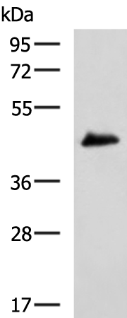 Rabbit Polyclonal Antibody to TMOD1