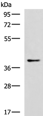 Rabbit Polyclonal Antibody to RAD23A