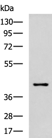 Rabbit Polyclonal Antibody to POC1A