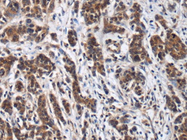 Rabbit Polyclonal Antibody to NHLRC2