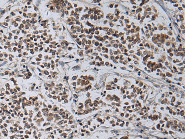 Rabbit Polyclonal Antibody to ZNF821