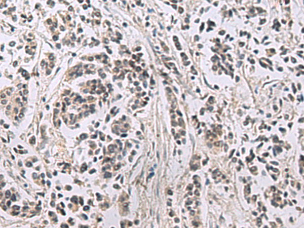 Rabbit Polyclonal Antibody to PPM1K