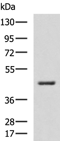 Rabbit Polyclonal Antibody to HSD3B2