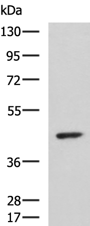 Rabbit Polyclonal Antibody to ARPC1B