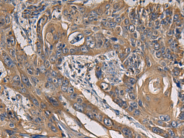 Rabbit Polyclonal Antibody to CCNI