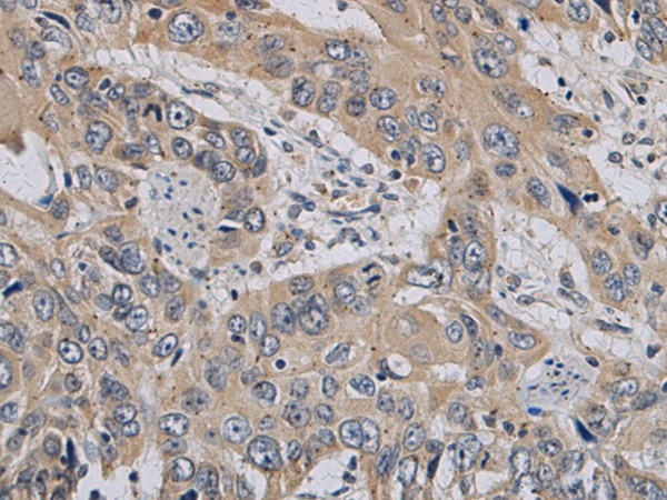 Rabbit Polyclonal Antibody to GPD2