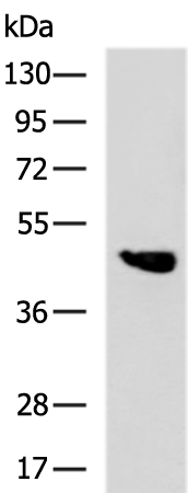 Rabbit Polyclonal Antibody to LYAR