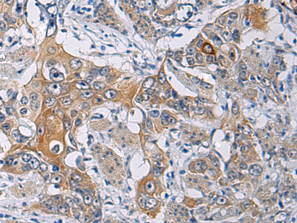Rabbit Polyclonal Antibody to KCNJ10