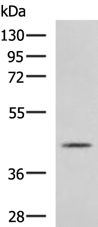 Rabbit Polyclonal Antibody to PRELP