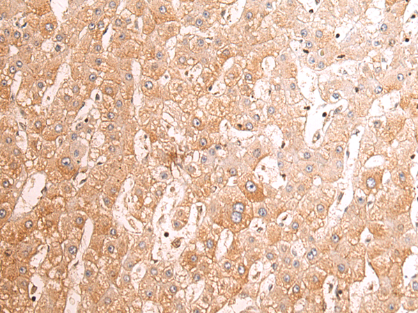 Rabbit Polyclonal Antibody to PIPOX