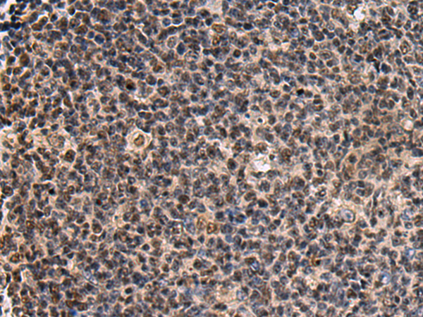 Rabbit Polyclonal Antibody to SIK3