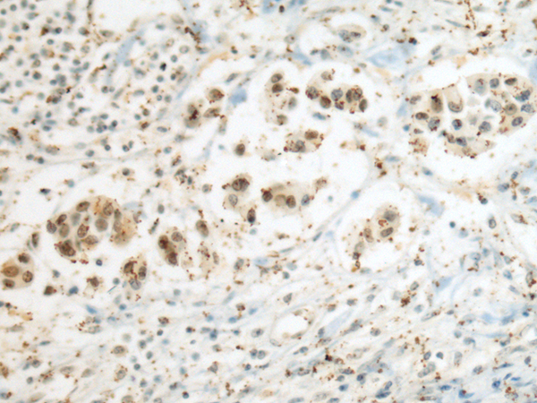 Rabbit Polyclonal Antibody to SEPHS1