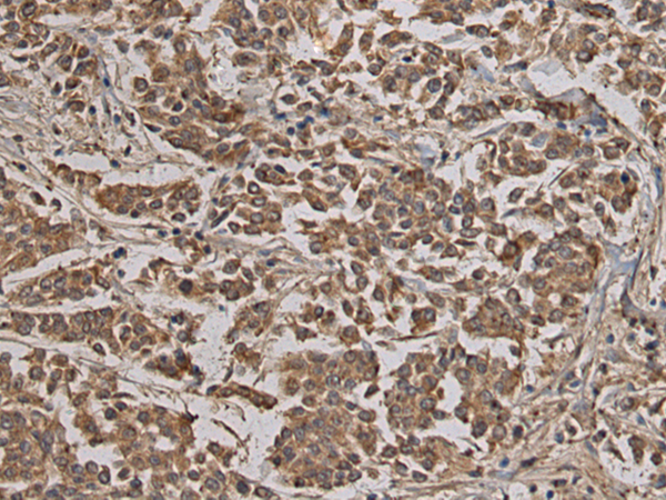 Rabbit Polyclonal Antibody to TLL1