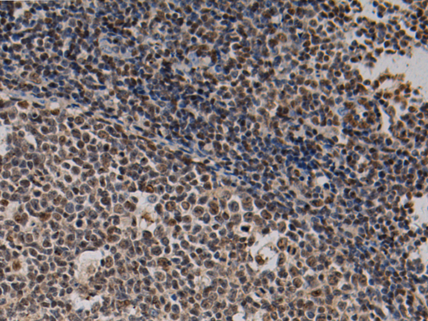 Rabbit Polyclonal Antibody to KIN