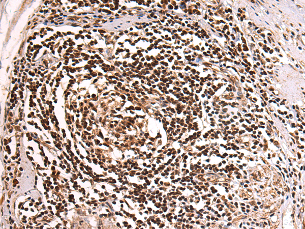 Rabbit Polyclonal Antibody to PHAX