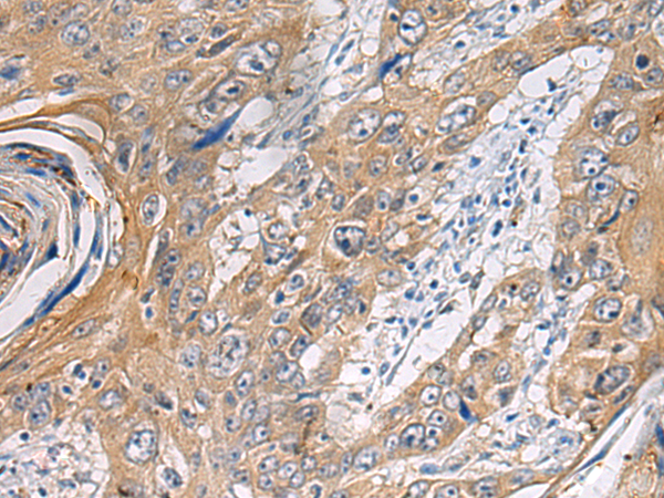 Rabbit Polyclonal Antibody to PA2G4