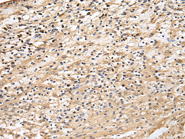 Rabbit Polyclonal Antibody to CRACR2A
