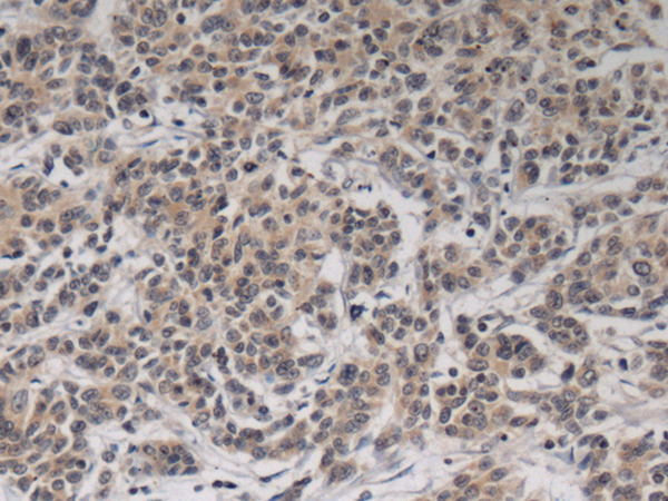 Rabbit Polyclonal Antibody to TFB2M