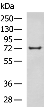 Rabbit Polyclonal Antibody to PRKCSH