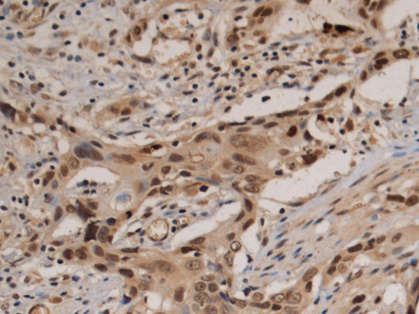 Rabbit Polyclonal Antibody to KLF12