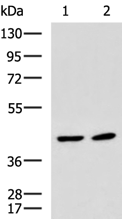 Rabbit Polyclonal Antibody to STK32B
