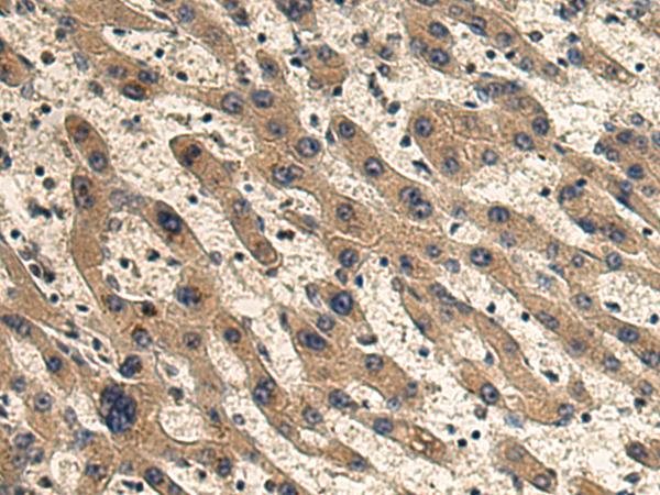 Rabbit Polyclonal Antibody to PSTPIP1