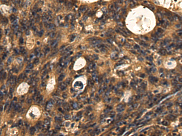 Rabbit Polyclonal Antibody to CBLIF
