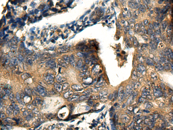 Rabbit Polyclonal Antibody to BCS1L