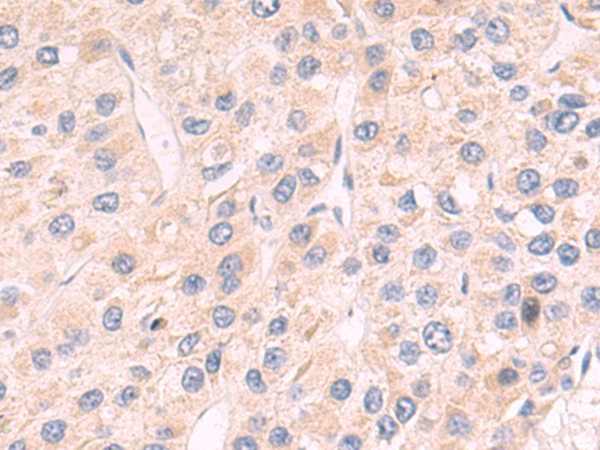 Rabbit Polyclonal Antibody to MRPS30