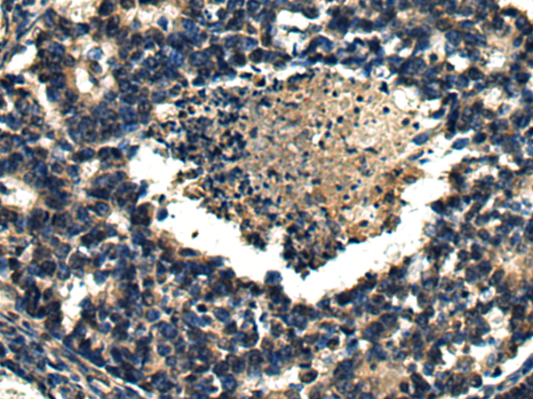 Rabbit Polyclonal Antibody to ARMT1